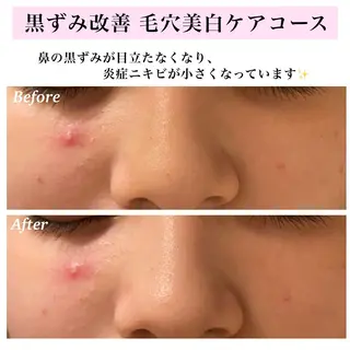 Bellesthe (ベルエステ)のエステ・リラクイメージ