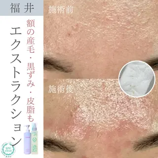 毛穴ケア専門サロン Yourmeユアミーのエステ・リラクイメージ