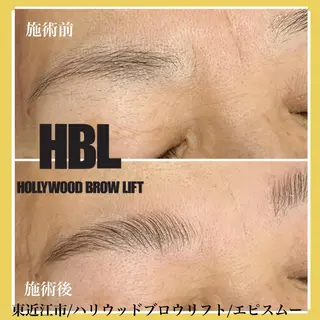 アイブロウ epismoo 脱毛/HBL/毛穴の眉毛・アイブロウイメージ