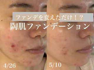 WHITE AQUA 北千住店のエステ・リラクイメージ