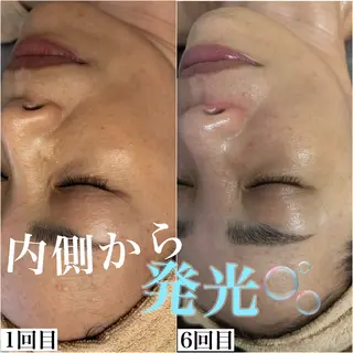 WHITE AQUA 北千住店のエステ・リラクイメージ