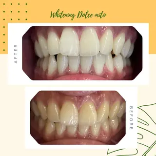 セルフホワイトニング Dolce水戸店のその他イメージ