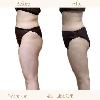 coco salon sou.所属・佐藤 由依のエステ・リラクイメージ