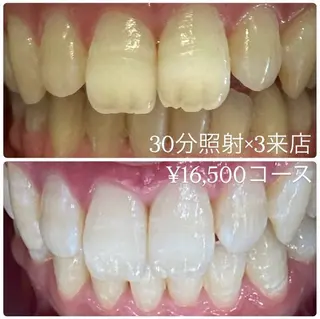 メンズ ホワイトニングルーム　川崎店所属・ホワイトニング ルーム　川崎店のその他イメージ