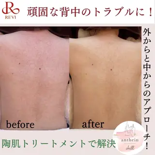 アンテインチル 山本のエステ・リラクイメージ