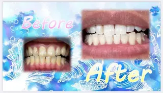 セルフホワイトニングサロン　ラヴィアン所属・ホワイトニングサロン La vie enのその他イメージ