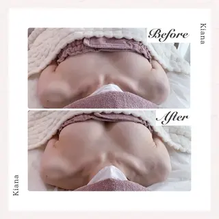 バスト専門Kiana 風のエステ・リラクイメージ