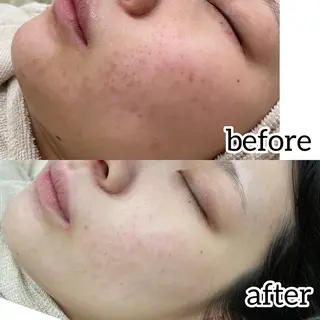 laluna saki...のその他イメージ