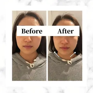 12Dハイフ💗 最強小顔のエステ・リラクイメージ