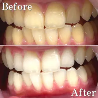 ショート パーマ カラー ヘアアレンジ メンズ ネイル マツエク・マツパ アイブロウ LBSホワイトニング 銀座店💎店長浦和のその他イメージ