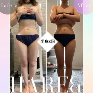 川西エステサロン Hare&のエステ・リラクイメージ