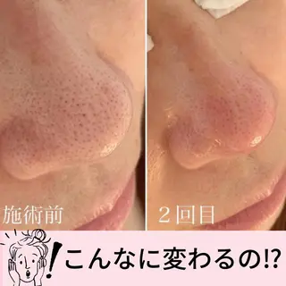 ■超絶小顔&肌管理室■所属・🦋整形級の究極美顔 本格韓国式小顔🦋のエステ・リラクイメージ