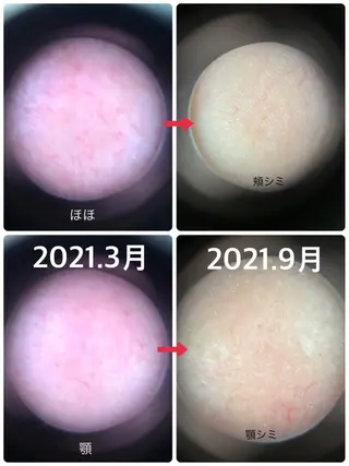 茂原 はるかのエステ・リラクイメージ