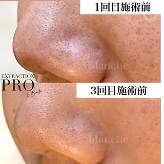 salon blancheのエステ・リラクイメージ