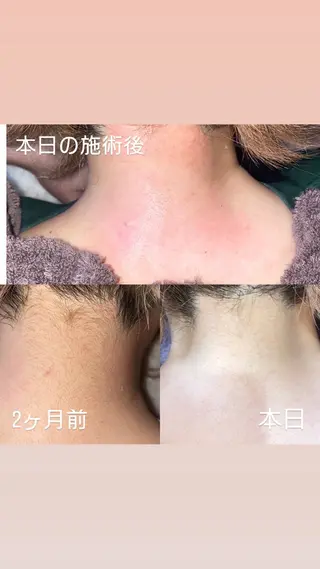 オズエフ所属・桑 奈都美の眉毛・アイブロウイメージ