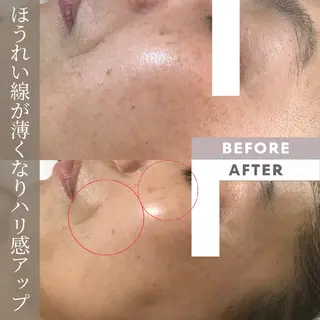 小顔エステサロン マインドール所属・泉大津エステ毛穴   シミ専門サロンのエステ・リラクイメージ