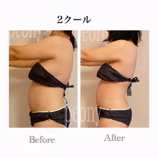 デトックス美容専門サロンpeony所属・デトックス美容専門 サロンpeonyのエステ・リラクイメージ