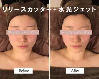 痩身×フェイシャル ブライダル|Linoのエステ・リラクイメージ