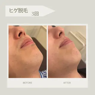 Syl.所属・Syl. シールのエステ・リラクイメージ