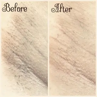 透明感の肌Lino malieのエステ・リラクイメージ