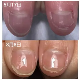 ネイル AKT NAIL所属・AKT Beauty エステヘッドスパのエステ・リラクイメージ