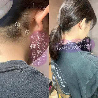 うなじラボ(UNAJI LABO)所属・池袋脱毛 さとうのエステ・リラクイメージ