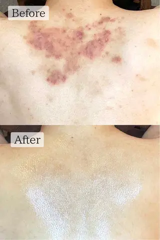 肌質改善専門サロン Bellmi/心斎橋のエステ・リラクイメージ