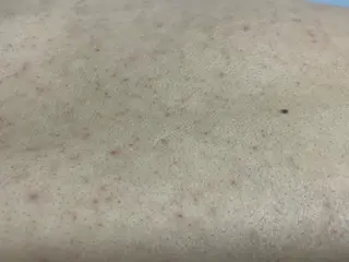 メンズ キッズ 脱毛SALON RaYNiCKのエステ・リラクイメージ