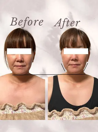 kuchimoto beauty couture  Ai所属・couture Aiのエステ・リラクイメージ