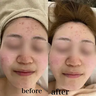 フェイシャルサロン CHIARA 荒田のエステ・リラクイメージ