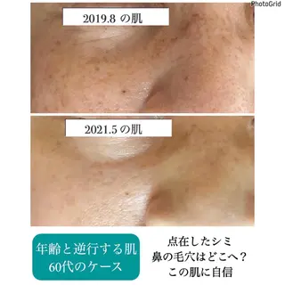 プチアンジェ所属・艶肌&小顔リフト❤︎ プチアンジェ茅ヶ崎のエステ・リラクイメージ