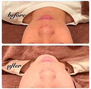 フルリール倉敷 /Kataokaのエステ・リラクイメージ