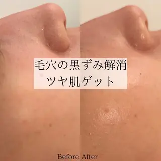 Ginza Charerのエステ・リラクイメージ