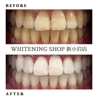 メンズ ホワイトニング ショップ新小岩店のその他イメージ