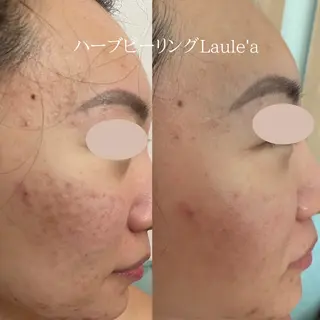 痩身/腸もみ/ ヘッドスパ/リンパのエステ・リラクイメージ