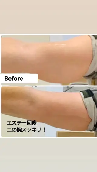 伊藤 遥香のエステ・リラクイメージ