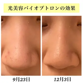 Bellesthe (ベルエステ)のエステ・リラクイメージ