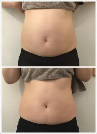 OPREA 千種店のエステ・リラクイメージ