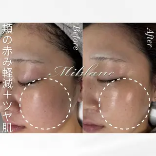 肌質管理 MIBLANC上野店のエステ・リラクイメージ
