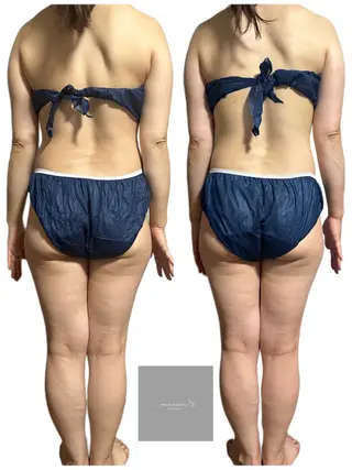 marron所属・痩身ハイパーナイフ ララピールリアボーテのエステ・リラクイメージ