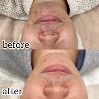 laluna saki...のその他イメージ