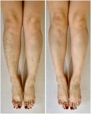 nin feaのエステ・リラクイメージ