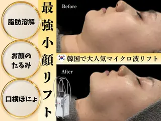 カンナムビューティー麻布十番店所属・bizz bizz 麻布十番🌿のその他イメージ