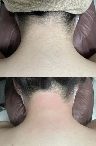 アイブロウ メンズ キッズ Epina 千葉店 【エピナ】のエステ・リラクイメージ