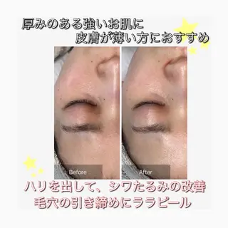 WhiteAqua 博多店　Erikoのエステ・リラクイメージ