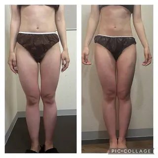 ハイパーナイフ専門店 Salon de COCO所属・Salon de COCOのエステ・リラクイメージ