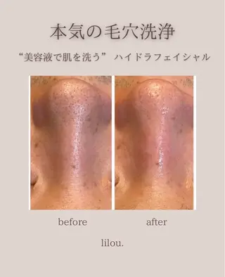 吉田 lilou.のエステ・リラクイメージ