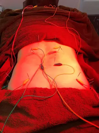 美容鍼灸整体サロンBeauJu所属・小顔矯/美容鍼/鍼灸 BeauJuのその他イメージ