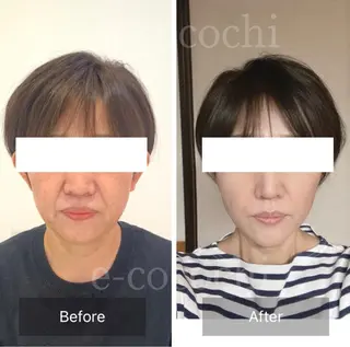 小顔と ヘッドスパのお店のエステ・リラクイメージ