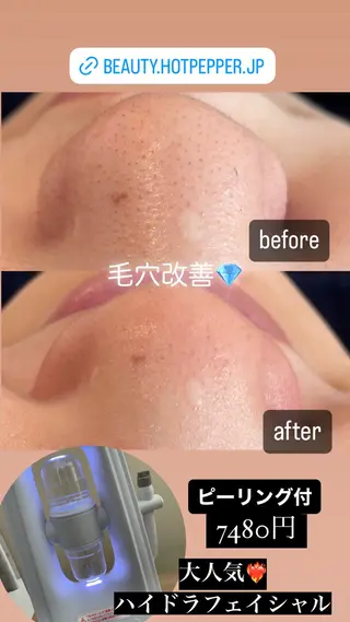 VERY VERY九条店所属・VERYVERY🌹 ビューティーサロンのエステ・リラクイメージ
